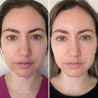 Alpha-H Vitamin B Serum voor en na resultaat