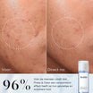 Medik8 Press & Clear voor en na, 96% ziet direct een verzachtend effect