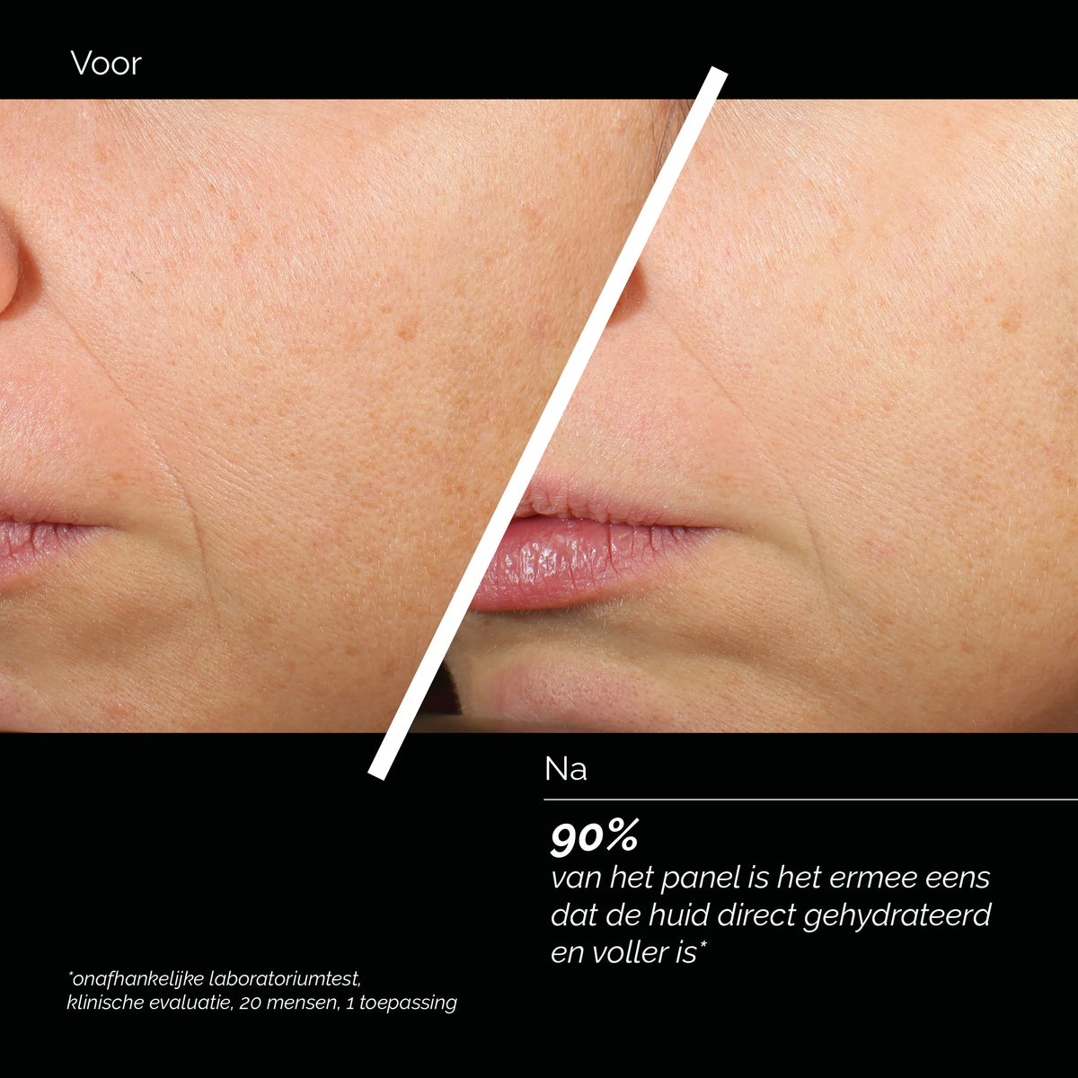 Comfort Zone Skin Regimen Lx HA4 Jelly Serum voor en na